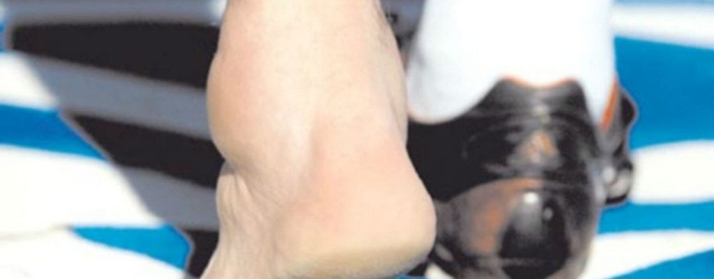tobillo de maradona